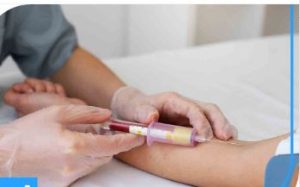 آزمایش کلیه در خانه: راهکاری برای تشخیص عملکرد کلیه در خانه