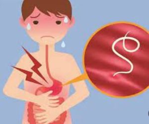 انگل‌های روده در کودکان